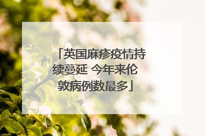 英国麻疹疫情持续蔓延 今年来伦敦病例数最多